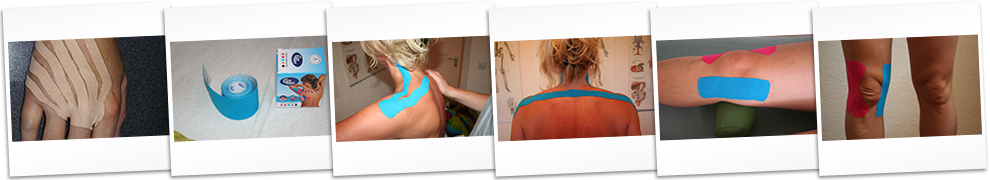 Medical taping